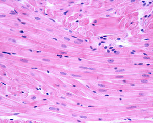 FWGE (Avemar) in the Treatment of Cardiac Remodeling and Metabolic Symptoms in Rats